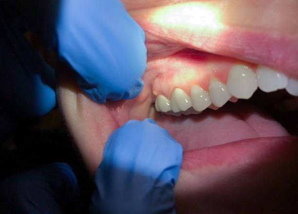 Best Mobile Emergency Dentist in Oak Lawn, IL
