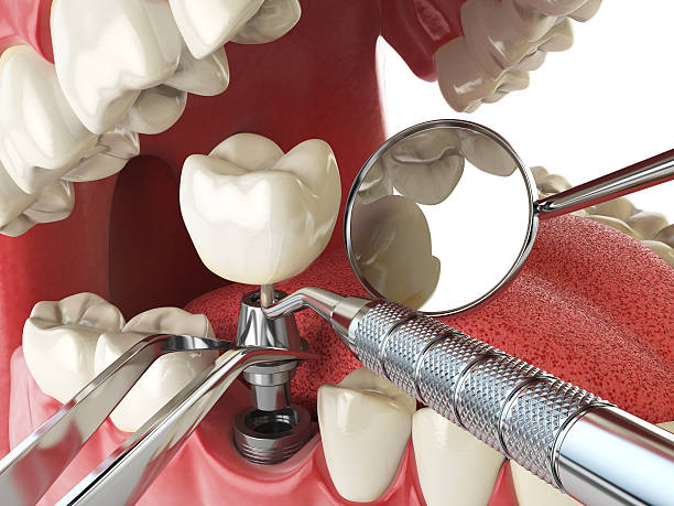 Best Weekend Emergency Dentist in Oak Lawn, IL